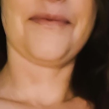 Josserotix Nude